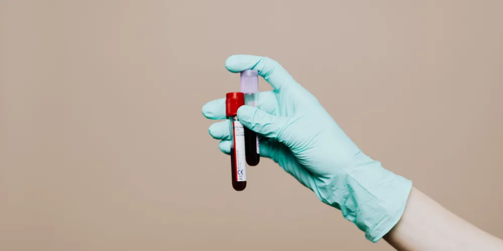 How Long Is Residential Treatment For Mental Health